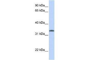UCK2 antibody used at 1 ug/ml to detect target protein. (UCK2 antibody  (N-Term))