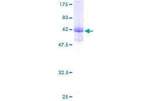 Chromosome 10 Open Reading Frame 81 (C10orf81) (AA 1-282) protein (GST tag)