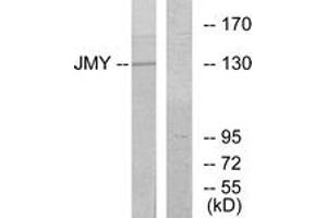 Western blot analysis of extracts from COLO cells, using JMY Antibody. (JMY antibody  (AA 931-980))