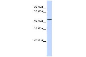 ELAC1 antibody used at 1 ug/ml to detect target protein. (ELAC1 antibody)