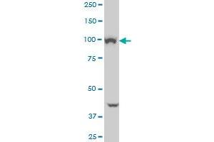 VPS11 monoclonal antibody (M01), clone 1H1 Western Blot analysis of VPS11 expression in K-562 . (VPS11 antibody  (AA 842-941))