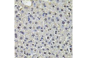 Immunohistochemistry of paraffin-embedded mouse liver using SP110 Antibody (ABIN6290941) at dilution of 1:100 (40x lens).