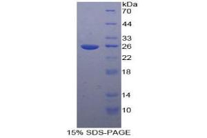 SDS-PAGE analysis of Human TICAM2 Protein.