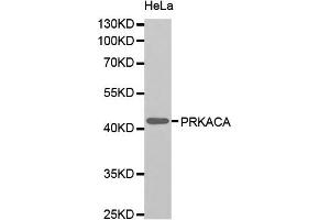 Western blot analysis of extracts of HeLa cell line, using PRKACA antibody. (PRKACA antibody)