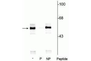 Western blot of rat brainstem lysate showing specific immunolabeling of the ~55 kDa TPH protein phosphorylated at Ser260 in lane one (-). (Tryptophan Hydroxylase 1 antibody  (pSer260))