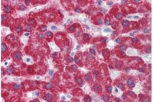 Human Liver: Formalin-Fixed, Paraffin-Embedded (FFPE) (Monoamine Oxidase B antibody  (AA 36-85))