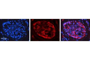 Rabbit Anti-PRKCZ Antibody   Formalin Fixed Paraffin Embedded Tissue: Human Testis Tissue Observed Staining: Cytoplasm Primary Antibody Concentration: 1:600 Other Working Concentrations: N/A Secondary Antibody: Donkey anti-Rabbit-Cy3 Secondary Antibody Concentration: 1:200 Magnification: 20X Exposure Time: 0. (PKC zeta antibody  (N-Term))