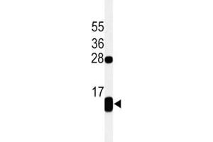 Western blot analysis of PLB / Phospholamban antibody and Jurkat lysate (Phospholamban antibody  (AA 1-30))