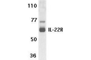 Western blot analysis of IL-22 receptor expression in human HepG2 cell lysate with AP30417PU-N IL-22 receptor antibody at 1 μg /ml.