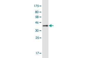 Western Blot detection against Immunogen (36. (MYLK4 antibody  (AA 3-100))