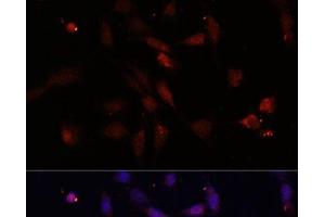 Immunofluorescence analysis of NIH/3T3 cells using c-Fos Polyclonal Antibody at dilution of 1:100. (c-FOS antibody)