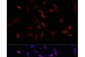 Immunofluorescence analysis of NIH/3T3 cells using c-Fos Polyclonal Antibody at dilution of 1:100. (c-FOS antibody)