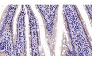 Immunohistochemistry (IHC) image for anti-Lactate Dehydrogenase B (LDHB) (AA 1-334) antibody (ABIN7433966)
