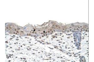 Image no. 1 for anti-Arrestin, beta 2 (ARRB2) (AA 151-200) antibody (ABIN6738415) (Arrestin 3 antibody  (AA 151-200))