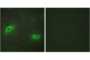 Immunofluorescence analysis of HeLa cells, using TNFSF9 antibody.