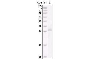Western Blot showing HER-2 antibody used against truncated HER-2 recombinant protein. (ErbB2/Her2 antibody)