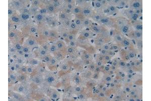 DAB staining on IHC-P; Samples: Human Liver Tissue (ITFG1 antibody  (AA 55-306))