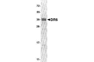 Western Blotting (WB) image for Tumor Necrosis Factor Receptor Superfamily, Member 21 (TNFRSF21) (AA 371-655), (Cytoplasmic Domain) protein (His tag) (ABIN2468352)