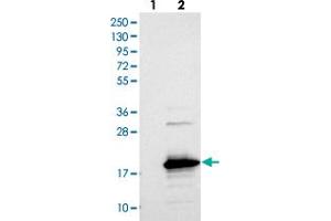 Western blot analysis of Lane 1: Negative control (vector only transfected HEK293T lysate), Lane 2: Over-expression Lysate (Co-expressed with a C-terminal myc-DDK tag (~3. (SAMD12 antibody)