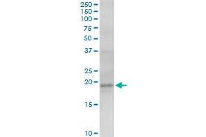 AGTRAP MaxPab polyclonal antibody. (AGTRAP antibody  (AA 1-152))