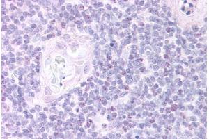 Human Thymus, Medulla (formalin-fixed, paraffin-embedded) stained with FOXN1 antibody ABIN297057 at 20 ug/ml followed by biotinylated anti-goat IgG secondary antibody ABIN481715, alkaline phosphatase-streptavidin and chromogen. (FOXN1 antibody  (AA 635-648))