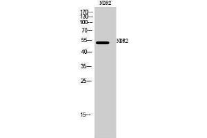 Western Blotting (WB) image for anti-serine/threonine Kinase 38 Like (STK38L) (C-Term) antibody (ABIN3185788) (STK38L antibody  (C-Term))