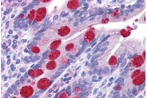 Immunohistochemistry (Formalin-fixed Paraffin-embedded Sections) (IHC (fp)) image for anti-Zinc Finger CCHC-Type and RNA Binding Motif 1 (ZCRB1) (C-Term) antibody (ABIN605091)