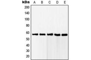 Western blot analysis of RAB11FIP2 expression in Jurkat (A), HeLa (B), MCF7 (C), A431 (D), HEK293 (E) whole cell lysates.