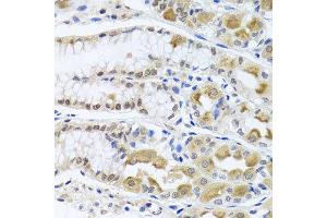 Immunohistochemistry of paraffin-embedded human gastric using TRMT1 antibody at dilution of 1:100 (x40 lens). (TRMT1 antibody)