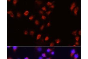 Immunofluorescence analysis of A431 cells using ACVR2A Polyclonal Antibody at dilution of 1:100 (40x lens). (ACVR2A antibody)