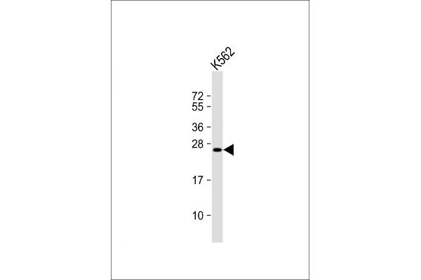 LRRC61 Antikörper  (AA 111-139)