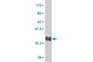 Western Blotting (WB) image for anti-Wingless-Type MMTV Integration Site Family, Member 7B (WNT7B) (AA 241-349) antibody (ABIN521388)