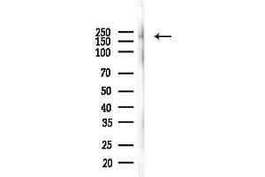 anti-Deleted in Colorectal Carcinoma (DCC) (C-Term) antibody