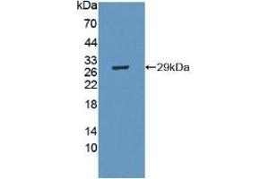 Detection of Recombinant CRISP1, Mouse using Polyclonal Antibody to Cysteine Rich Secretory Protein 1 (CRISP1) (CRISP1 antibody  (AA 20-244))