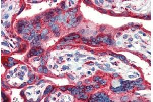 Human Placenta (formalin-fixed, paraffin-embedded) stained with HSP90B1 antibody ABIN462106 at 10 ug/ml followed by biotinylated secondary antibody, alkaline phosphatase-streptavidin and chromogen. (GRP94 antibody)