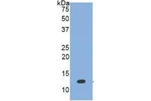 WB of Protein Standard: different control antibodies  against Highly purified E. (BMP7 ELISA Kit)