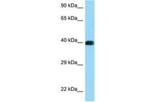 Image no. 1 for anti-CD72 Molecule (CD72) (AA 273-322) antibody (ABIN6748123) (CD72 antibody  (AA 273-322))