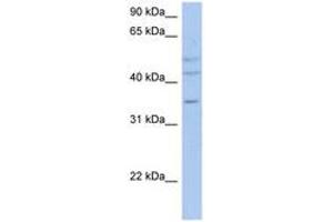 Image no. 1 for anti-PXYLP1 / ACPL2 (AA 71-120) antibody (ABIN6743334) (PXYLP1 / ACPL2 (AA 71-120) antibody)