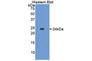 Western Blotting (WB) image for anti-Amyloid P Component, Serum (APCS) (AA 20-223) antibody (ABIN1174754) (APCS antibody  (AA 20-223))