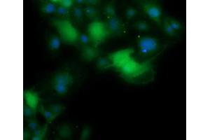 Image no. 3 for anti-Anaphase Promoting Complex Subunit 11 (ANAPC11) antibody (ABIN1496632)