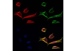 ABIN6264064 and ABIN6277250 staining Hela cells by IF/ICC. (PCBP2 antibody  (Internal Region))