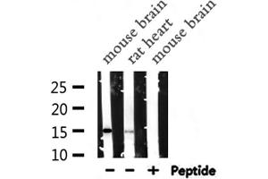 Western blot analysis of PFN1  expression in various lysates (PFN1 antibody  (C-Term))