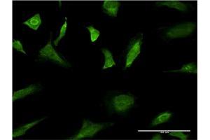 Immunofluorescence of monoclonal antibody to MAPK3 on HeLa cell. (ERK1 antibody  (AA 279-379))