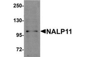 Western blot analysis of NALP11 in HeLa cell lysate with NALP11 antibody at 1 μg/ml. (NLRP11 antibody  (C-Term))