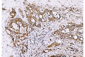 IHC analysis of GPR54/KISS1R using anti-GPR54/KISS1R antibody (ABIN7602153). (KISS1R antibody  (AA 60-373))
