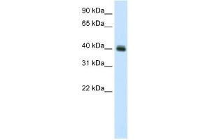 WB Suggested Anti-PUS1 Antibody Titration:  0. (PUS1 antibody  (C-Term))