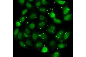 Immunofluorescence analysis of MCF7 cells using DR1 antibody (ABIN6130316, ABIN6139817, ABIN6139819 and ABIN6217241). (DR1 antibody  (AA 1-176))