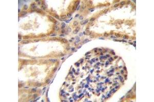 DDR1 antibody immunohistochemistry analysis in formalin fixed and paraffin embedded human kidney tissue. (DDR1 antibody  (AA 17-47))