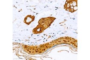 Immunohistochemistry of paraffin embedded rat skin using Annexin-A8 (ABIN7073071) at dilution of 1: 1600 (400x lens) (Annexin VIII antibody)