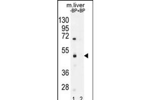 Western blot analysis of SD8 Antibody (N-term) Pab (ABIN655974 and ABIN2845359) pre-incubated without(lane 1) and with(lane 2) blocking peptide in mouse liver tissue lysate. (SAMD8 antibody  (N-Term))